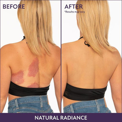 💫Last Day Promotion✨Beauty Body Coverage Perfector – Waterproof, lightweight & flawless body makeup